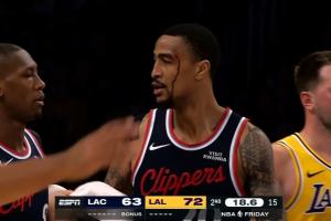 太危险了！科林斯空接时被海斯顶翻 头着地磕破眼角鲜血直流