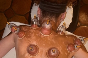 库兹马未婚妻社媒晒两人度假照 体验了一把中式拔罐