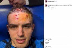 补时最后时刻造点！克尔斯托维奇社媒晒伤口照：很快球场再见！