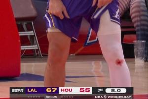 东契奇&库里膝盖出血之谜：不是药水 而是地板擦伤留下的真实血迹